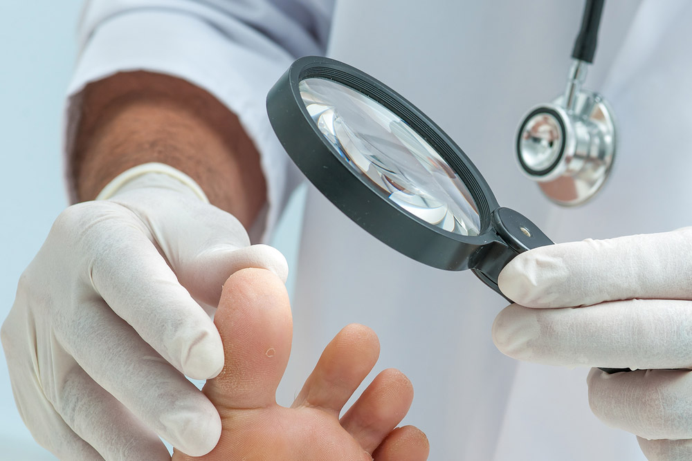 Ayak Mantarı Oluşmuş Parmak Arası